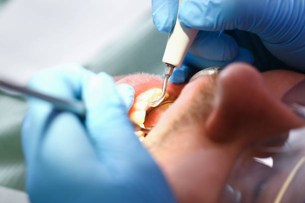 Best Same-Day Emergency Dentist in Wilson, OK