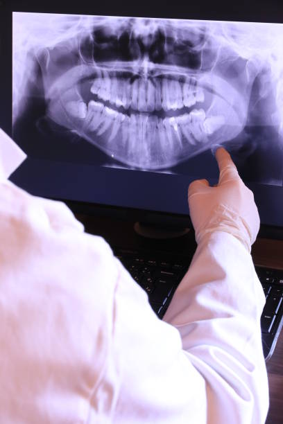 Best Emergency Wisdom Teeth Removal in Wilson, OK